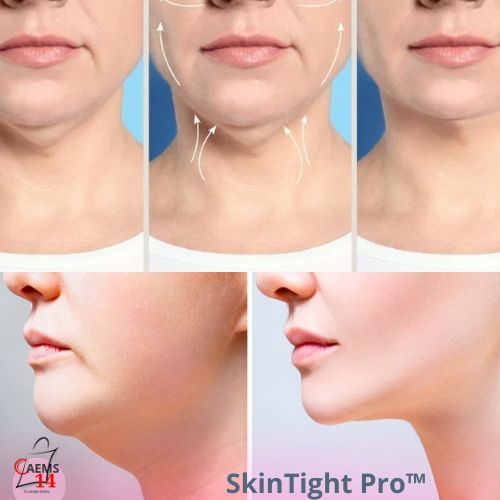 MASAJEADOR LED ANTIEDAD,  CUELLO Y ROSTRO  SKIN TIGHT PRO™  ⭐⭐⭐⭐⭐